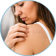 Woman scratching dry, itchy skin caused by hard water